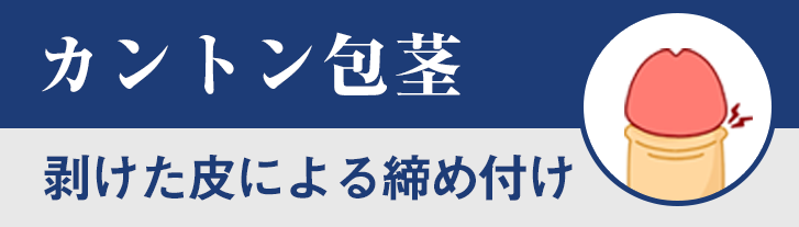 カントン包茎（剥けた皮による締め付け）