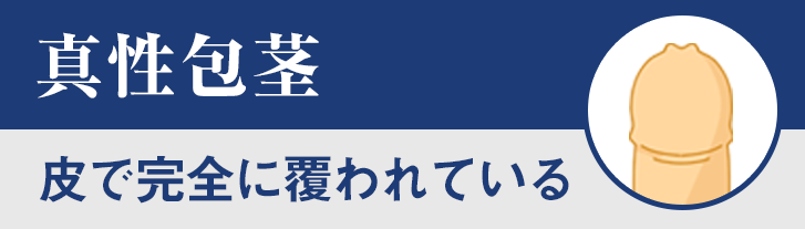 真性包茎（皮で完全に覆われている）